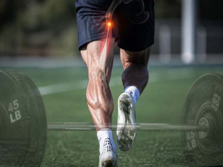 Hamstring Injury in Football Recovery